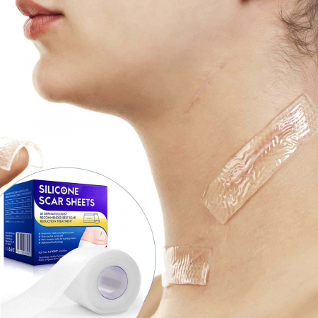 Rola Premium din Silicon Medical Transparent pentru Cicatrici, Reutilizabila, NOVA KISS®, 4 cm x 3 m1