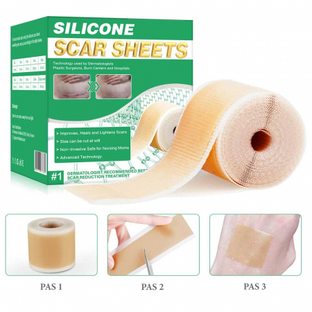 Rola Premium Reutilizabila din Silicon Medical pentru Ascunderea & Ingrijirea Cicatricilor, NOVA KISS®, 4 cm x 1.5 m5