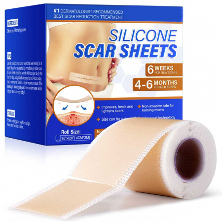 Rola Premium Reutilizabila din Silicon Medical pentru Cicatrici, NOVA KISS®, 4 cm x 3 m8