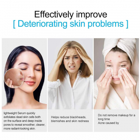 Ser Facial Premium Anti Acnee, Anti pori dilatati si Anti pete pigmentare cu Acid salicilic si 2% BHA, Sefudun, 30 ml4