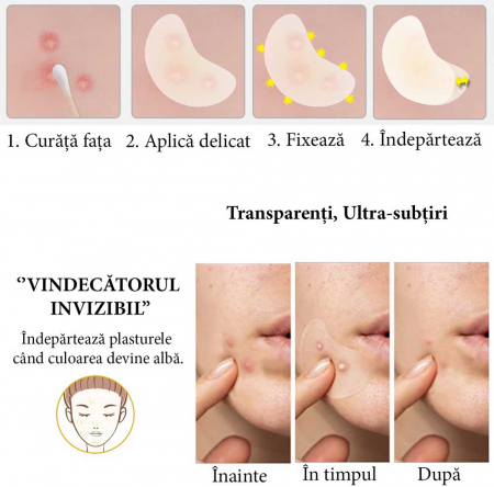Plasturi Hidrocoloidali Anti-Acnee, Set 20 Bucăți, Transparenți, Ultra-subțiri, Formulă Premium1