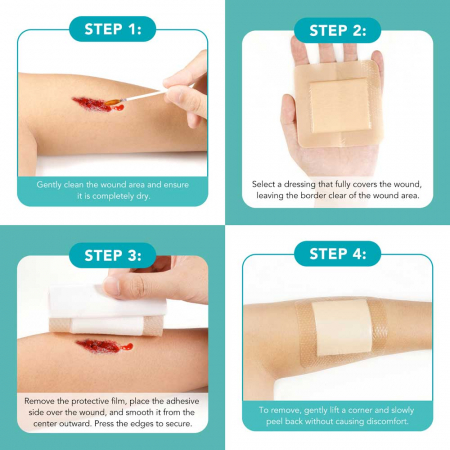 Comprese Premium pentru Cicatrici din Spuma de Silicon cu Argint si Margine Adeziva, 5 buc, 10 cm x 10 cm11