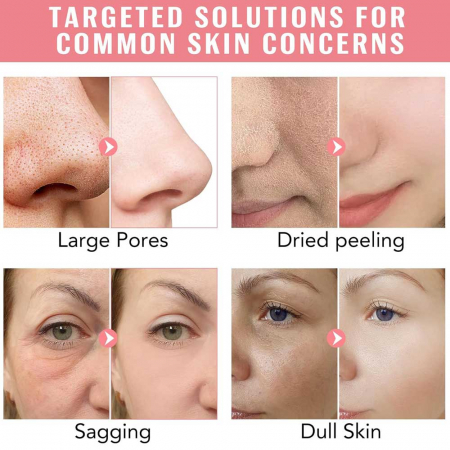 Set Tratement Premium 4 Masti BIO Colagen, Formula Avansata cu Probiotice, Tehnologie HydroGel5