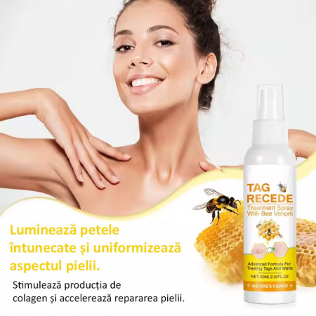 Spray cu Venin de Albine pentru Indepartarea Alunitelor si Negilor, NOVA KISS®, 60 ml1