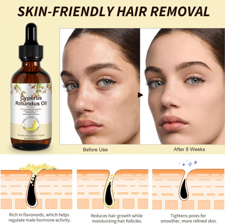 Ulei Cyperus Rotundus pentru Incetinirea Cresterii Firelor de Par, Formula 100% Naturala, NOVA KISS®, 60 ml7