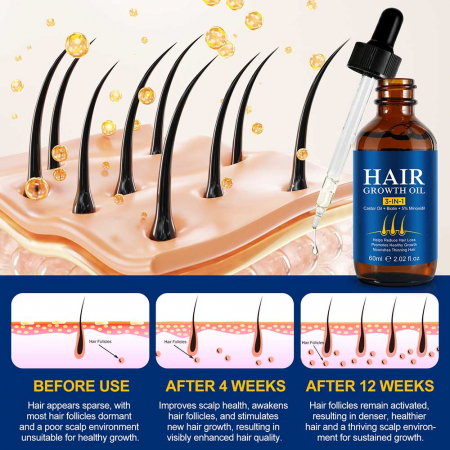 Ulei Premium 3 in 1 pentru Cresterea Parului cu Minoxidil, Biotina si Ulei de Ricin, 60 ml4