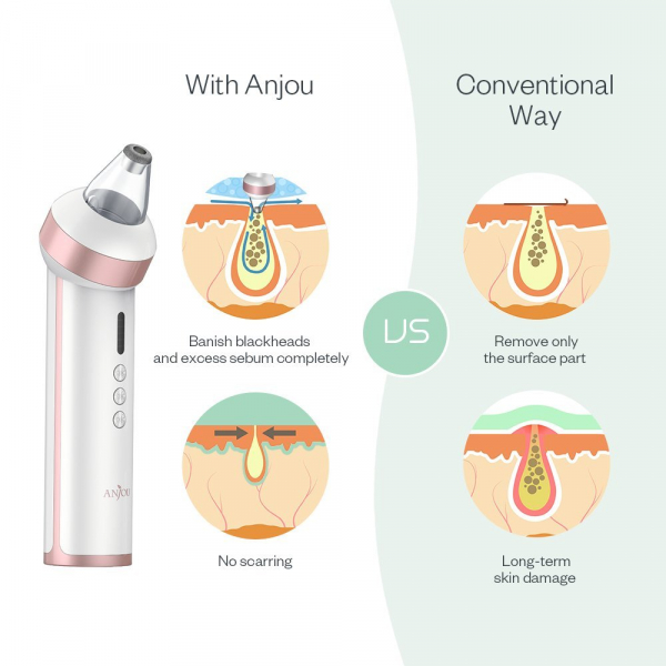 Aparat vacuum multifunctional Anjou AJ-PCA015 Indepartare Puncte Negre, Anti Acnee, Aspirator cosuri, Curatare pori, 4 capete detasabile [9]