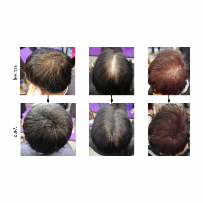Pudră de păr instant, Hair Wonder, 04 Maro Rosiatic, Tana [4]