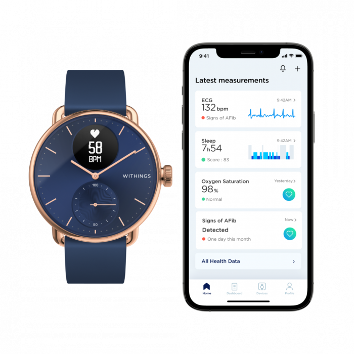 Withings Scanwatch 38mm - Rose Gold Blue [2]