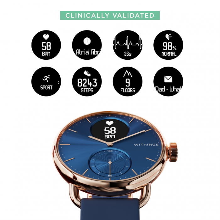 Withings Scanwatch 38mm - Rose Gold Blue [3]