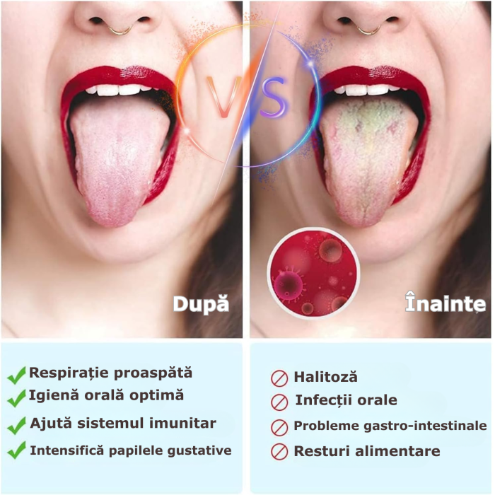 dispozitiv curatare limba [7]