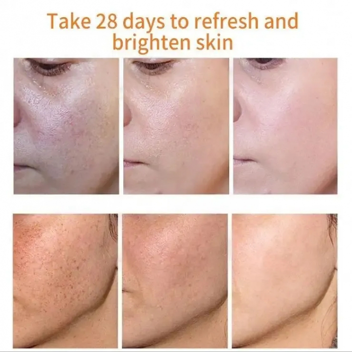 Crema cu retinol pentru albire pistrui si pete cauzate de expunerea la soare, 20 g [3]