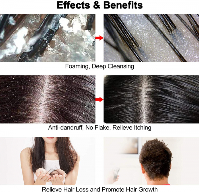 Perie masaj scalp [4]