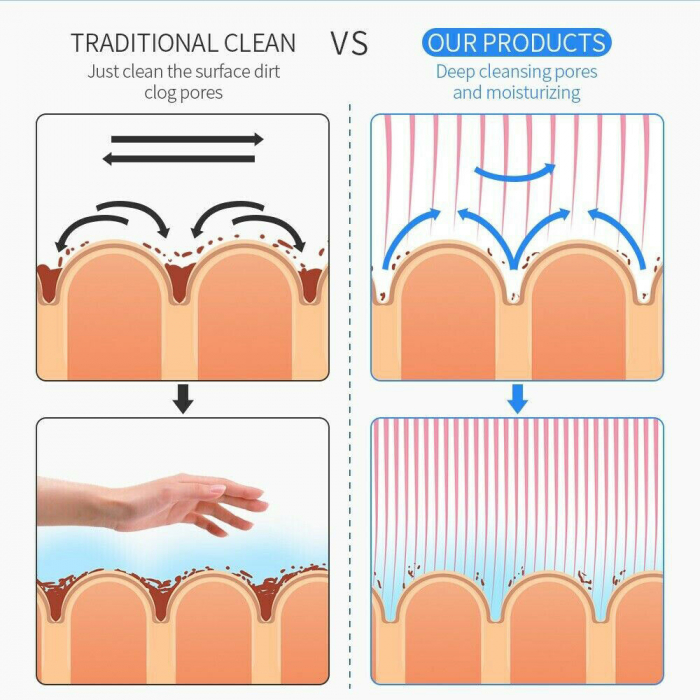 Aparat Cosmetic Profesional 6 in1 H2 O2 Jet Hidroxigen Micro Bule [8]