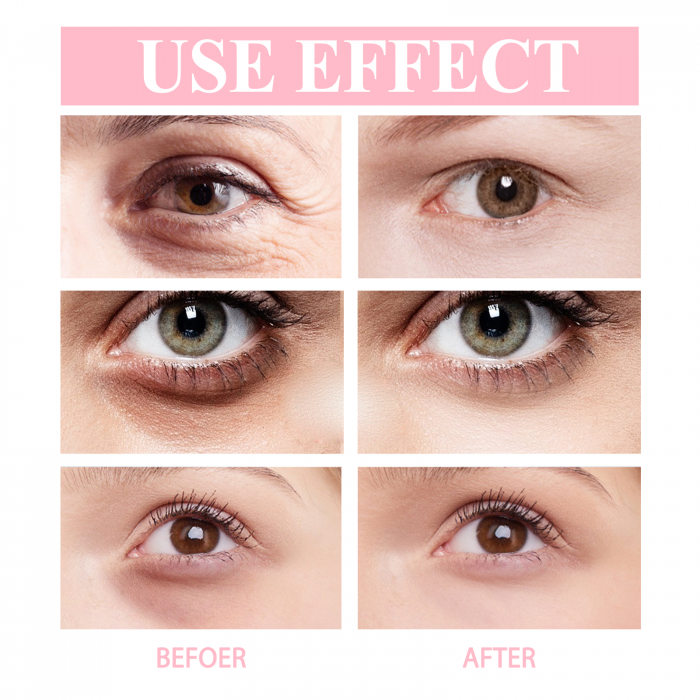 stick-retinol-acid-hialuronic-cearcane-riduri-smartsale.ro [6]