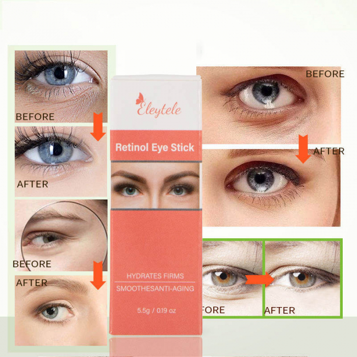 stick-retinol-acid-hialuronic-cearcane-riduri-smartsale.ro [3]