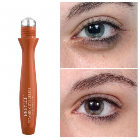 ser-albire-cearcane [1]