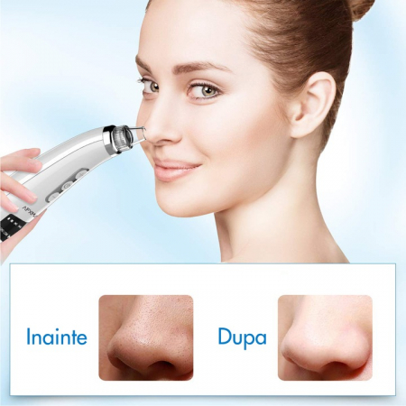 Aparat Smart extras puncte negre cu vacuum, WeOne, 5 Puteri ajustabile, 5 capete, LCD display, Ingrijire ten, Incarcare USB [4]