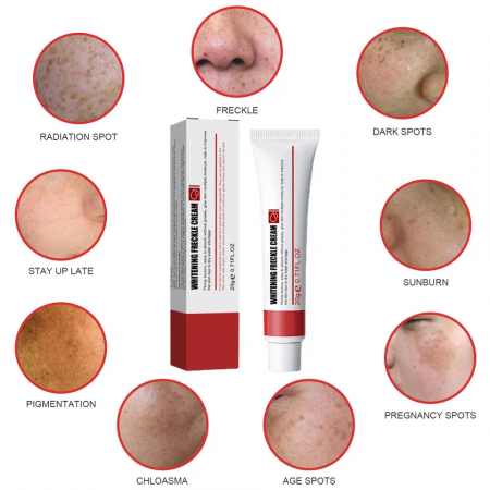 Crema cu retinol pentru albire pistrui si pete cauzate de expunerea la soare, 20 g [3]