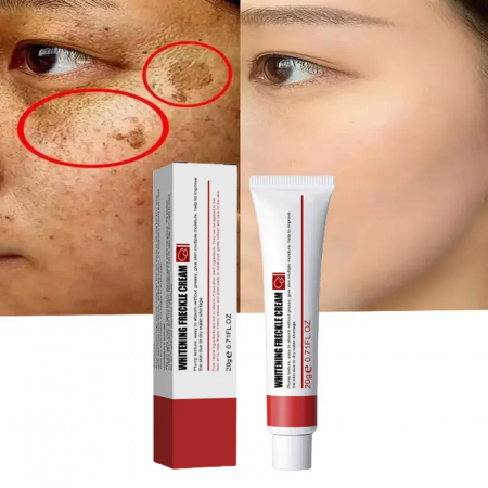 Crema cu retinol pentru albire pistrui si pete cauzate de expunerea la soare, 20 g [1]