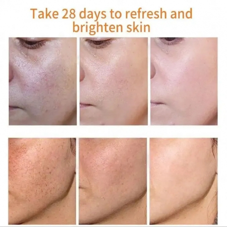 Crema cu retinol pentru albire pistrui si pete cauzate de expunerea la soare, 20 g [2]