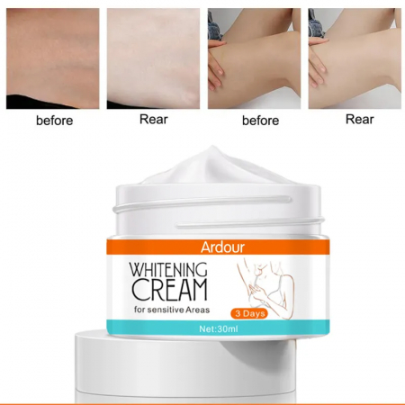 Crema pentru albirea pielii formula eficienta in 3 zile zone sensibile ingrediente naturale, 30 ml [1]