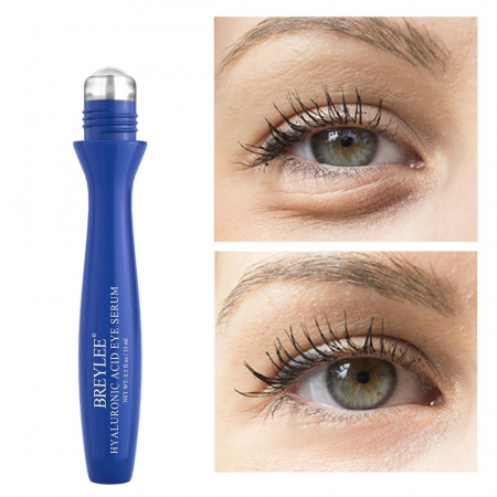 ser-acid-hialuronic-ochi [2]