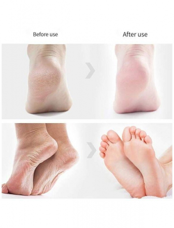 Freza electrica profesionala pentru picioare, indepartare piele uscată, crapata, tare și calusuri, OEM [8]