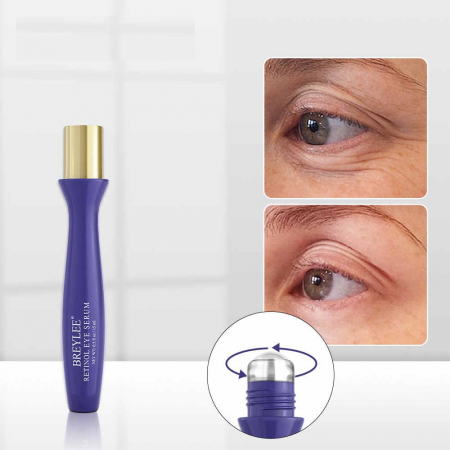 ser-retinol-ochi [2]