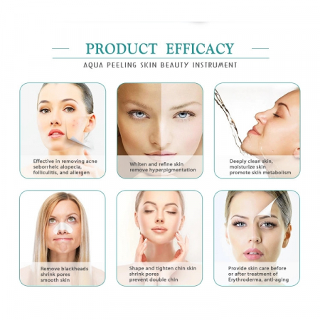 Aparat Cosmetic 5 in 1 Crioterapie Faciala, Masaj bionic, EMS, Lifting [9]