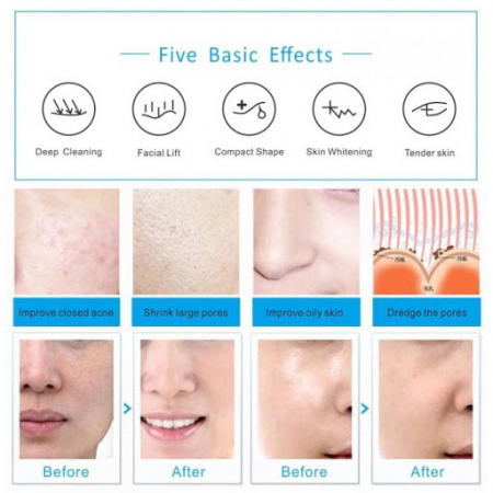 Aparat Cosmetic Profesional 6 in1 H2 O2 Jet Hidroxigen Micro Bule [9]