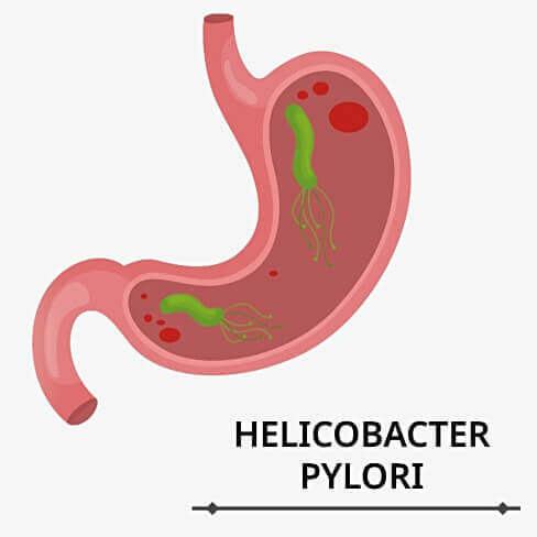 HelicoBiotic supliment tratament bacteria Helicobacter pylori Zenyth - TopSuplimente [2]