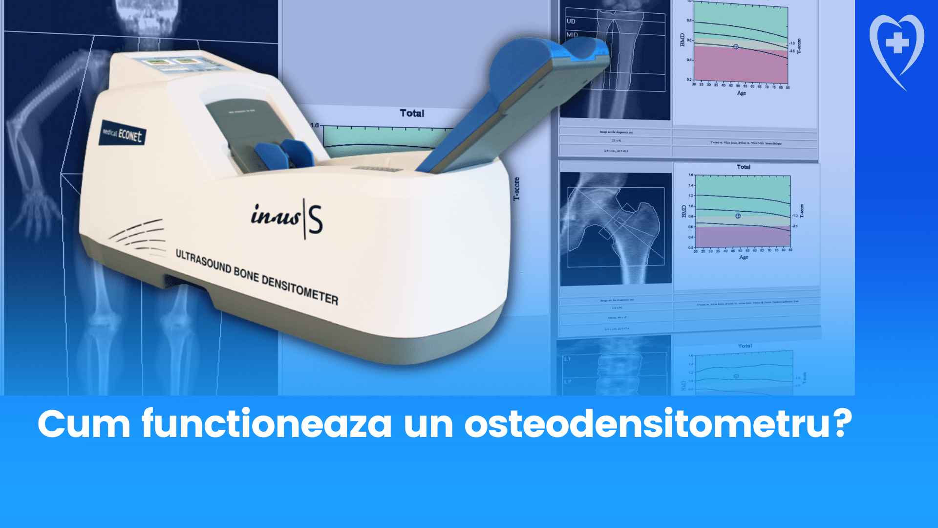 Cum functioneaza un osteodensitometru?