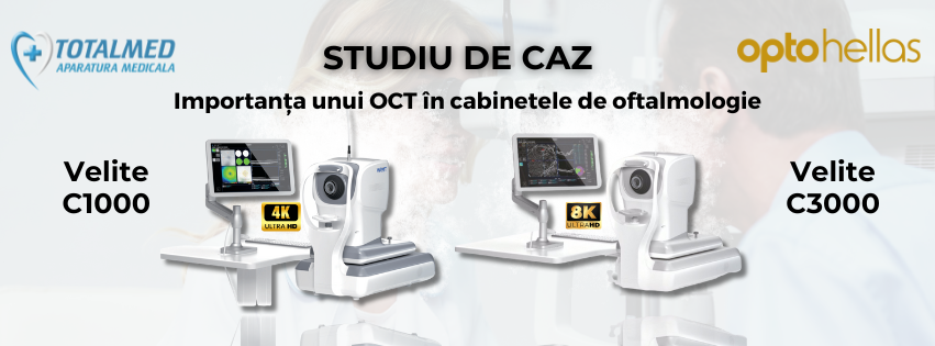 Importanța unui OCT în cabinetele de oftalmologie