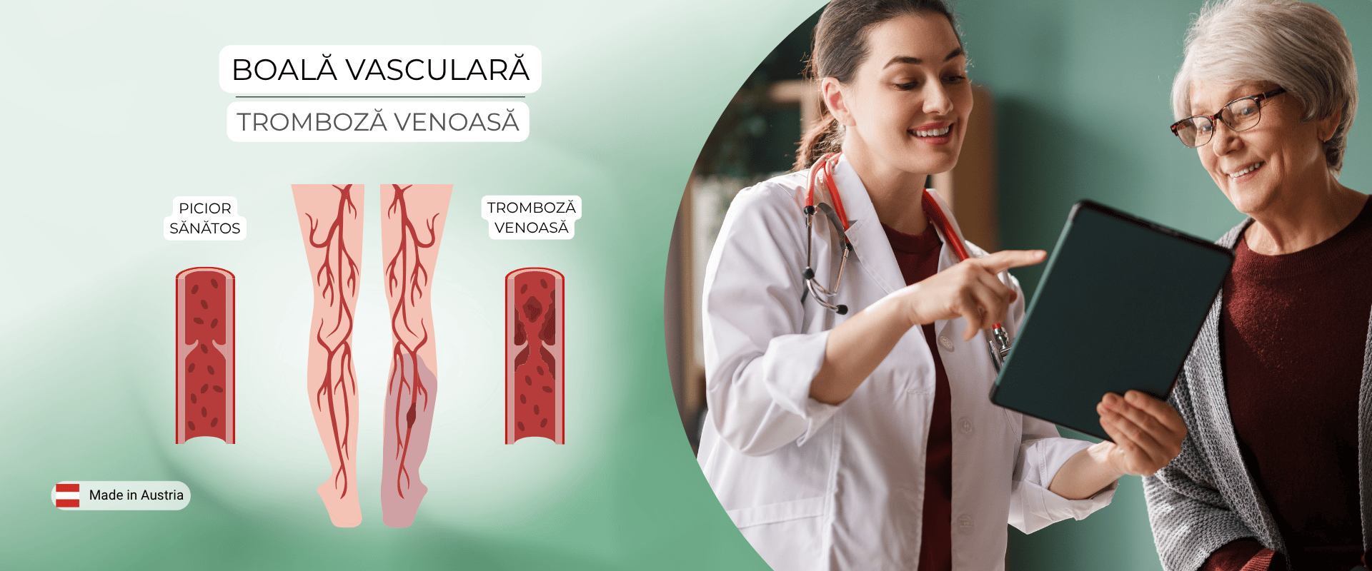 Înțelegerea trombozei venoase: cauze, simptome și depistare precoce