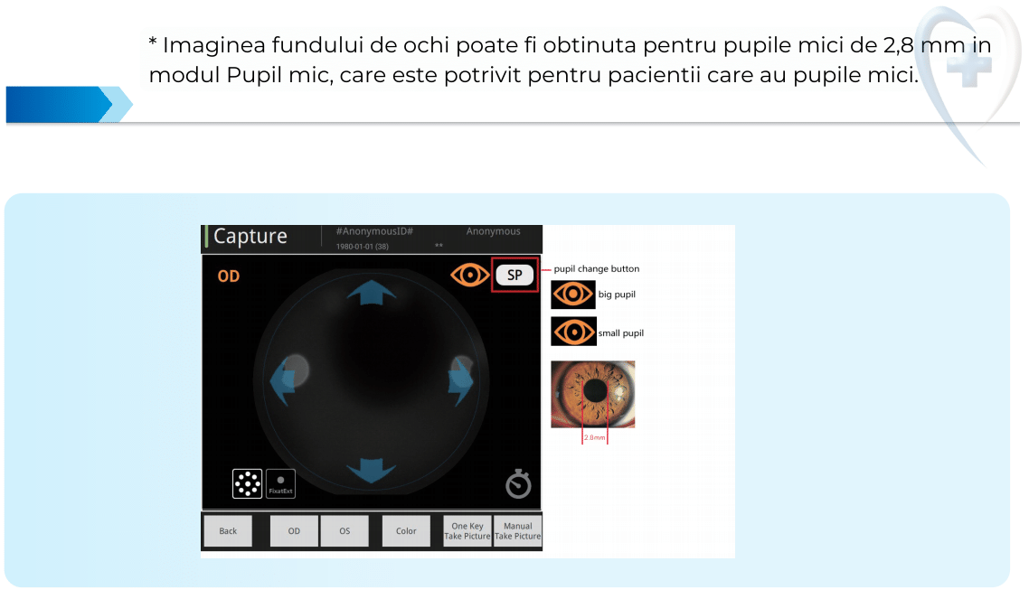 fundus camera