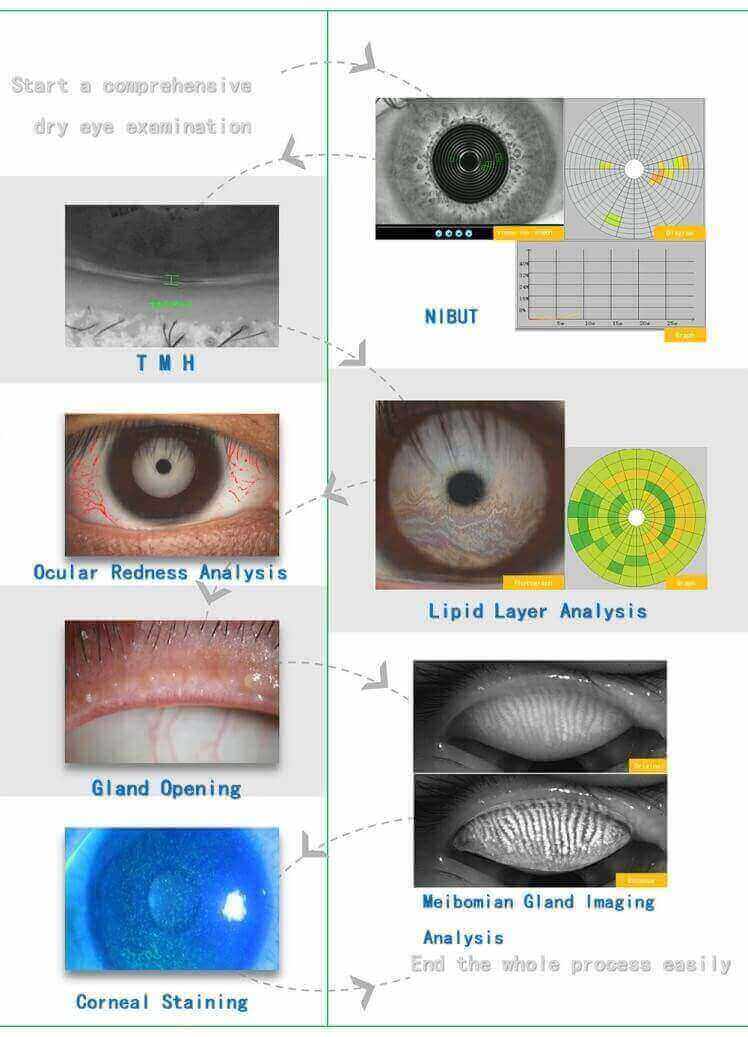 analizor ocular
