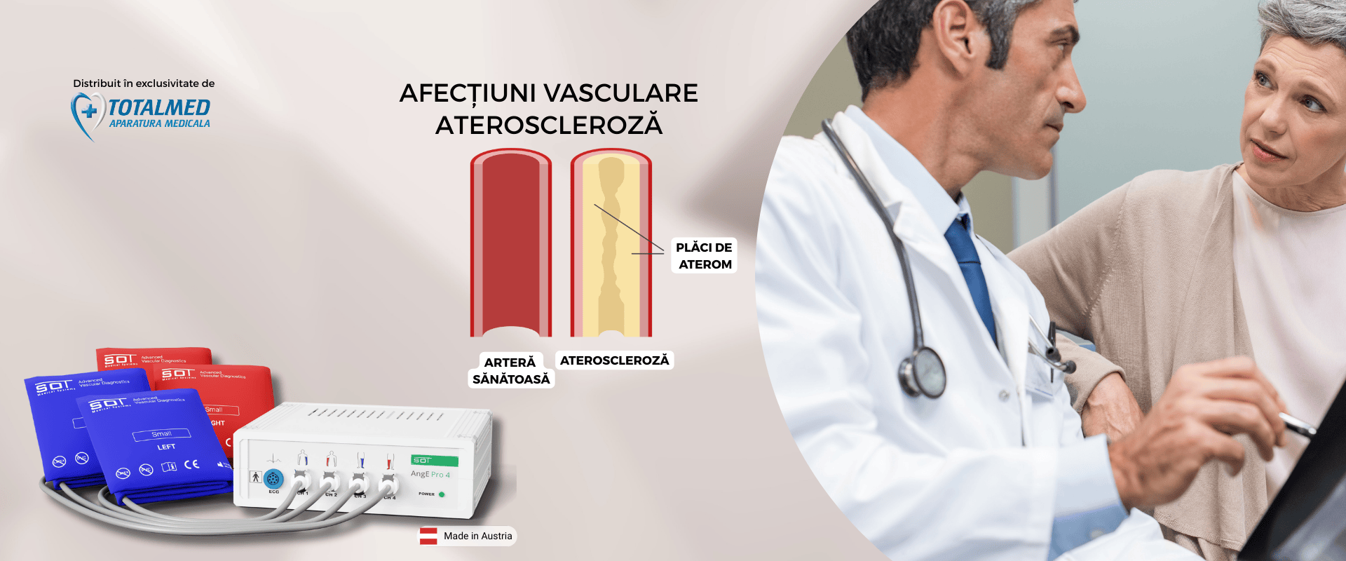 Cum ajută indicele gleznă-braț AngE™ ABI+ depistarea precoce a Aterosclerozei