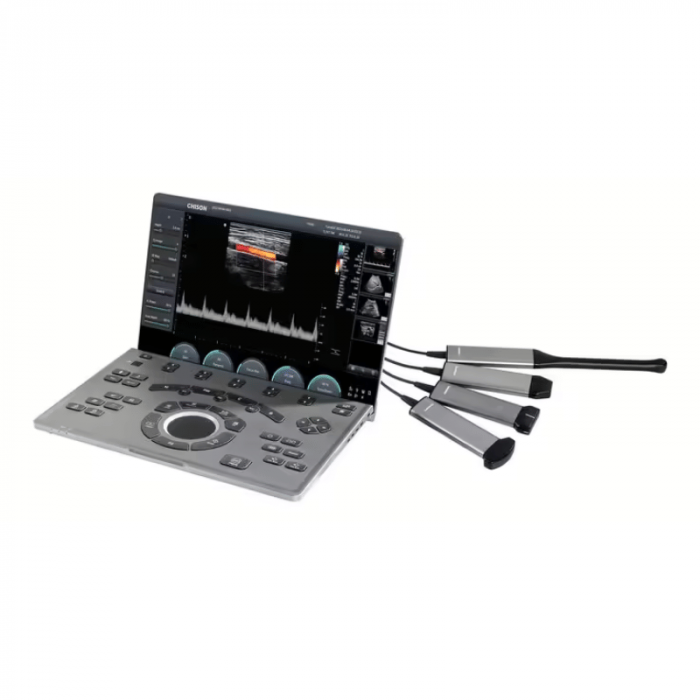 Ecograf ultraportabil tip laptop SonoAir 30 [3]
