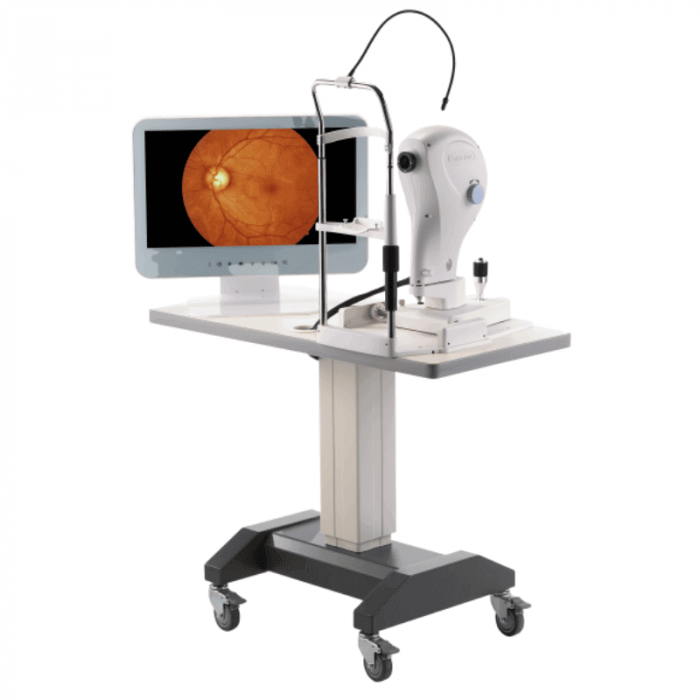 Fundus Camera FundusVue cu joystick | Totalmed Aparatura Medicala [3]