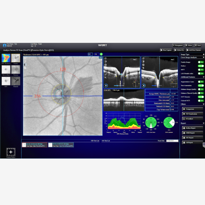 OCT/A EYEFOS 1K cu AI, tomograf în coerență optică 4K pentru diagnostic retinian și glaucom [3]