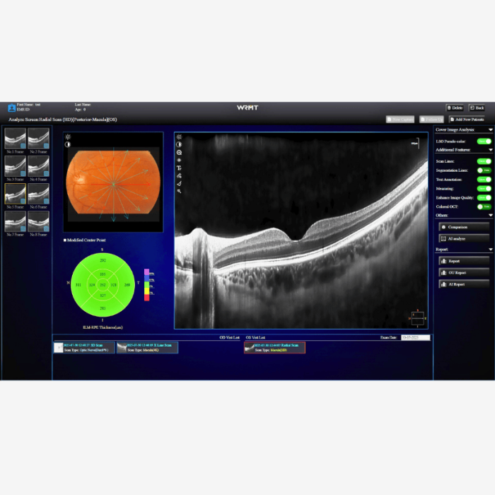 OCT/A EYEFOS 1K cu AI, tomograf în coerență optică 4K pentru diagnostic retinian și glaucom [4]