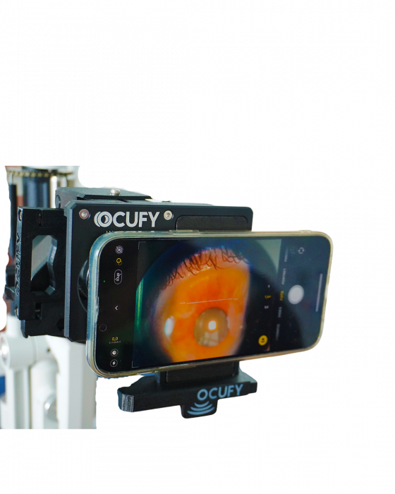 Sistem de digitizare pentru biomicroscoape OCUFY [2]