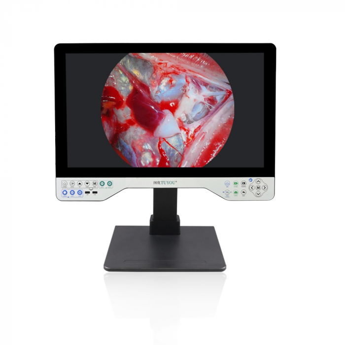 Sistem video endoscopic ALL IN ONE, 24 Inch 4K [4]