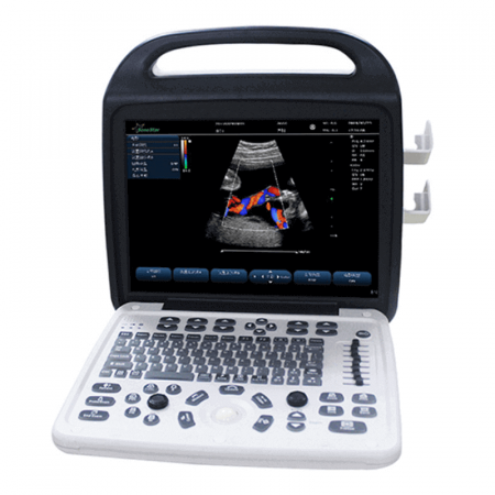Ecograf tip laptop C10M Color Doppler System | Totalmed Aparatura Medicala [0]