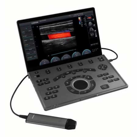 Ecografe - Ecograf ultraportabil tip laptop SonoAir 30