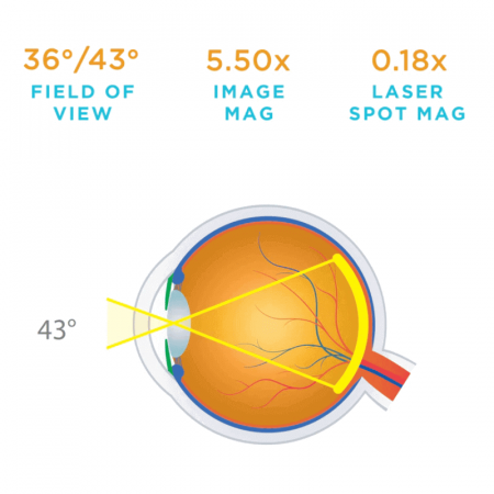 Lentila VOLK Clasica Macula Plus® 5.5 | Totalmed Aparatura Medicala [1]