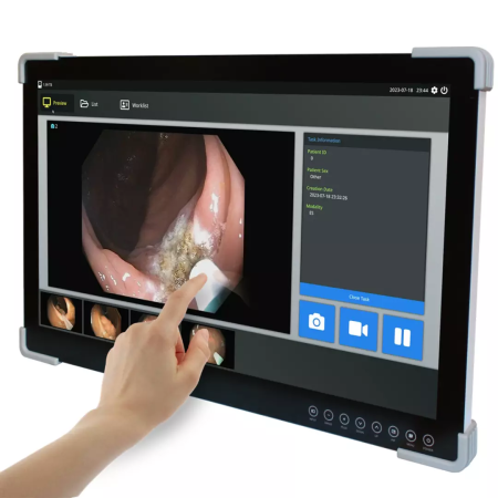 Monitoare lampi operatie Rimsa - Monitor 27" TOUCH pentru lampa operatie Rimsa