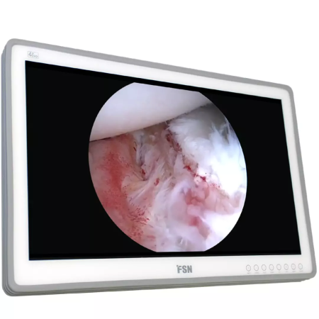 Monitoare lampi operatie Rimsa - Monitor medical 4K de 27" pentru lampă chirurgicală RIMSA
