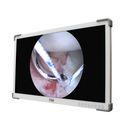 Monitoare lampi operatie Rimsa - MONITOR MEDICAL FHD 32” pentru lampă chirurgicală RIMSA